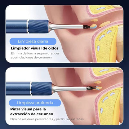 Limpiador de oídos inteligente inalámbrico con cámara (Android/iOS)